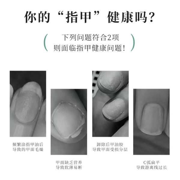 Wholesale Nutrition Oil Anti-dead Skin Barb Moisturizing Nutrition Pen Nail Liquid