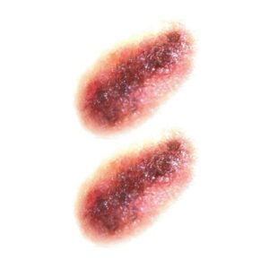 ∮20 pieces of large size burn style